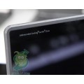Лаптоп Acer Chromebook Spin 11 R751TN
